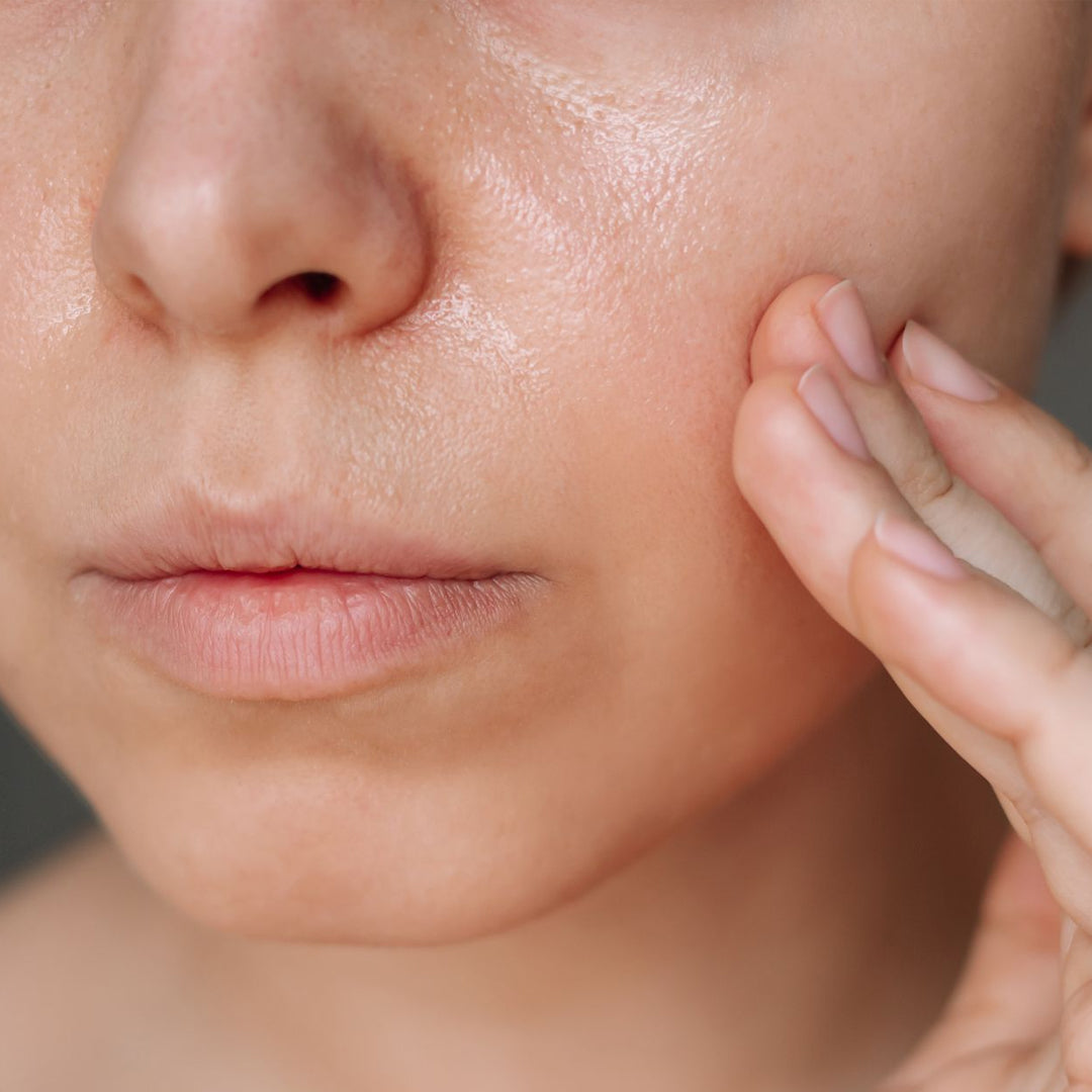 Oily Skin البشرة الدهنية